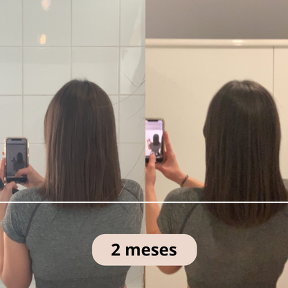 Sozuna-Pro : Bolsa de crecimiento capilar