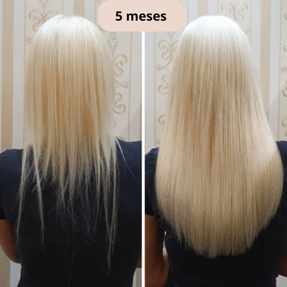 Sozuna-Pro : Bolsa de crecimiento capilar