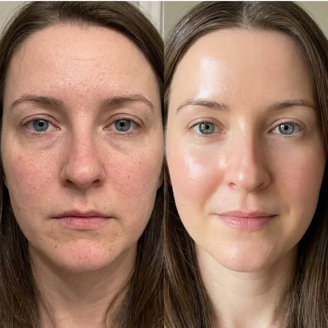 Sozuna SculptBrush™ — Drain the puff. Reveal your face