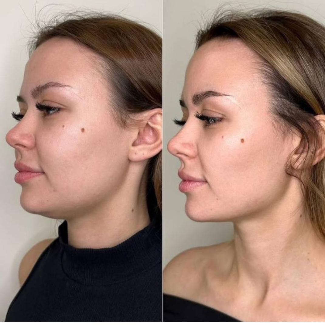 Sozuna SculptBrush™ — Drain the puff. Reveal your face